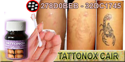 Obat Penghapus Tatoo | Penghilang Tatoo Permanen